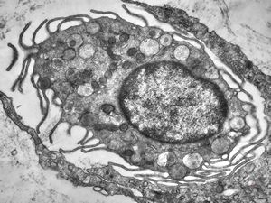 M, 13y. | mast cell M, 13y. | mast cell